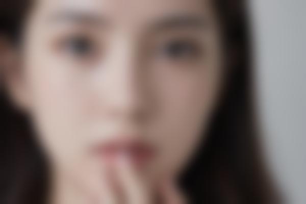 重庆曹阳医生双眼皮修复技术绝了！眼整形失败找曹阳修复价格合理自然