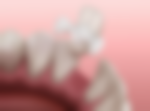 有哪些推荐的医院可以进行全口吸附性义齿治疗？