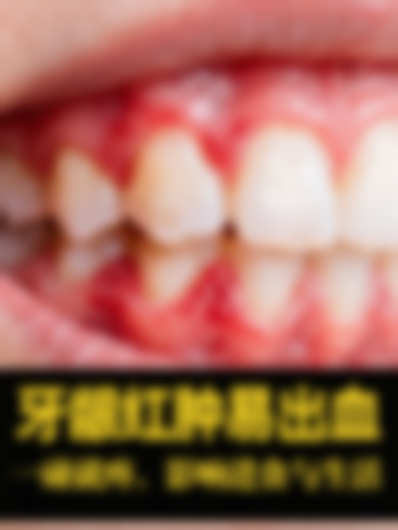 慢性炎症或轻微红肿能拔牙吗？