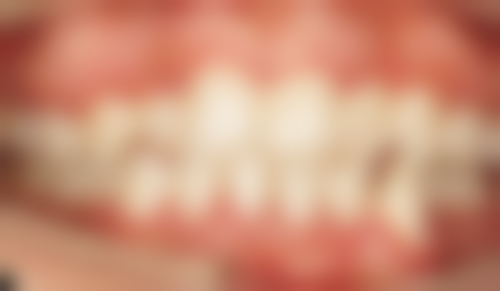 江门新时代口腔诊所黄荣海医生擅长项目