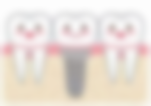 烤瓷牙的尺寸是怎么设计的，能自己调整大小吗？