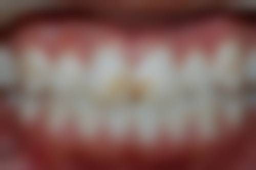 不同情况下有哪些修复方案？