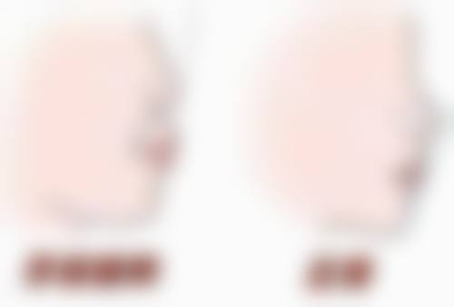 自己在家给孩子拔牙的操作步骤是怎样的呢？