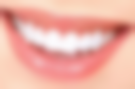 洗牙后口腔护理还有哪些注意事项？