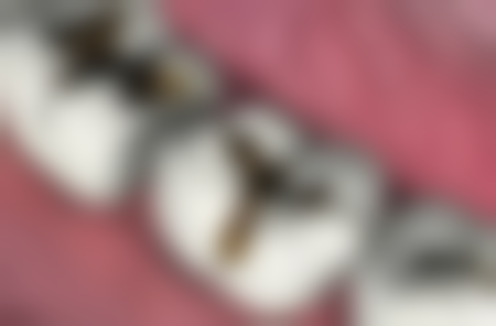 北京京大博爱口腔门诊部收费价格表