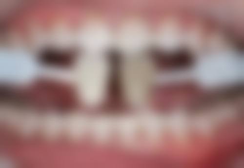 怎么观察创面愈合情况，出现什么症状要复诊呢？