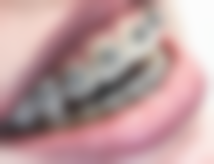 北京京大博爱口腔门诊部叶丽萍手术服务:贴心又周到