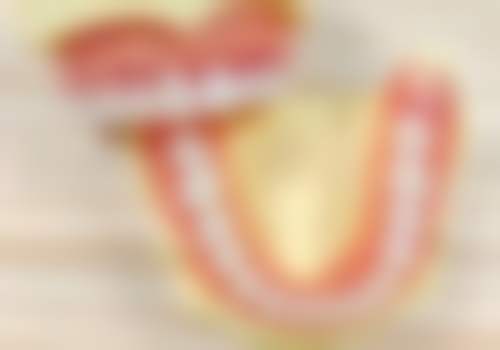 种植牙齿医疗保险报销有哪些避坑提醒和医院选择建议？