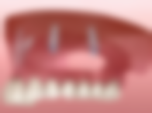 常州美玉兰口腔门诊部怎么预约