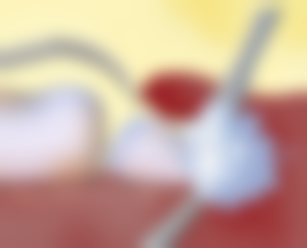 拔牙后出现哪些情况需要尽快就医评估呢?