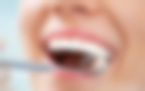 补牙以后多少时间可以吃东西？树脂补牙和银汞合金补牙后可进食时间有何不同？ 