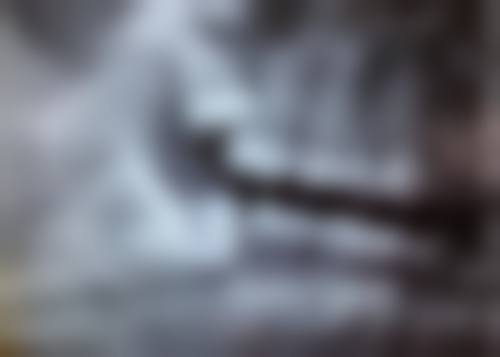 北京京大博爱口腔门诊部舌侧矫正（全舌侧）的成效如何？