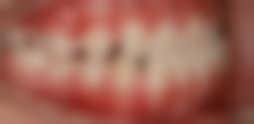 山东东营胜利口腔医院怎么样？