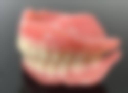 什么是种植牙和牙冠的区别？从适用情况、使用寿命、价格方面为你详细解析！ 