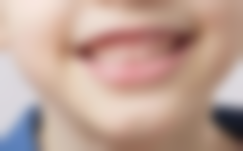 拔牙不吃早饭会怎样？可能导致低血糖、晕厥，还会影响拔牙后身体恢复你了解吗？ 