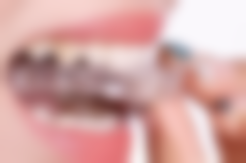 根管治疗有哪些情况可能保留牙髓呢？