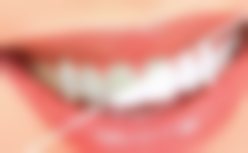 如何根据自身口腔条件选择种植牙？