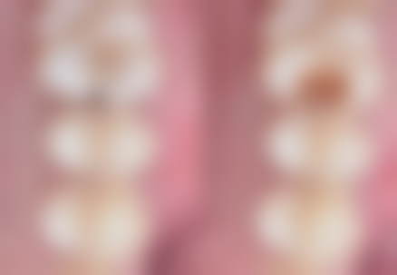 绍兴越城口腔医院口碑评价怎么样?