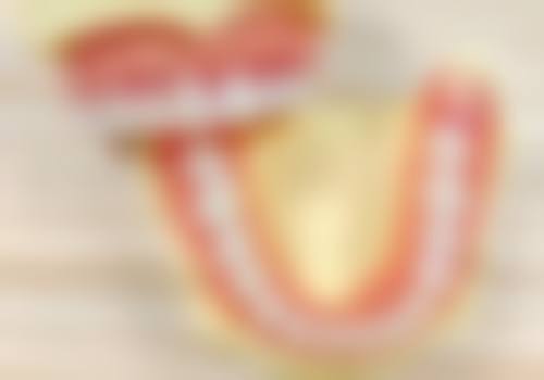 使用社保卡拔牙有什么注意事项？