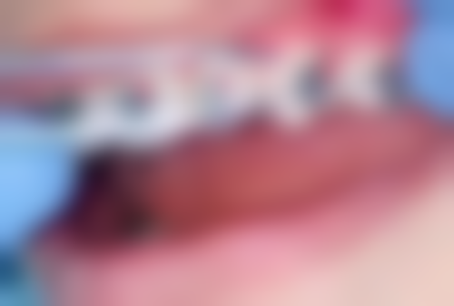 广州夏阳口腔正规吗?