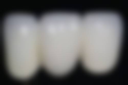 儿童早期干预阶段的修复时间是怎样的呢？