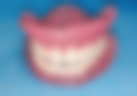 粘接剂老化导致的烤瓷牙松动怎么处理？