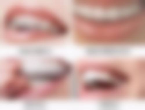 做的全瓷牙有点变黑了怎么办？是清洁不到位还是材料问题，该如何解决？ 