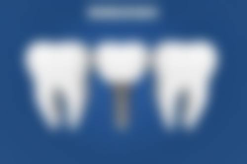 拔牙后牙床出现黑色硬物还有可能是什么呢？