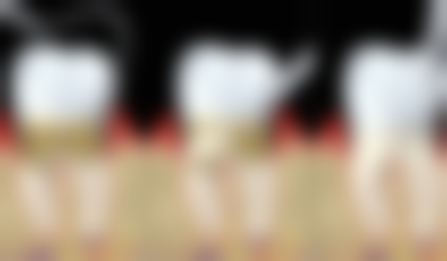 广西桂林廖宏荣口腔怎么预约