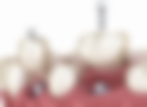 宁夏吴忠同心张学亮口腔诊所口碑评价怎么样?