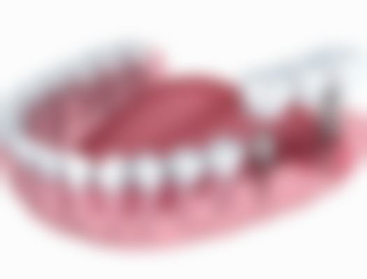 拔牙后肿胀一直不消该怎么办？