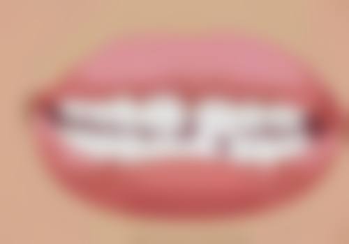 洗牙对牙齿过敏有什么好处呢？