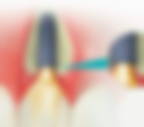 杭州牙科医院(临平城北口腔医院)怎么预约