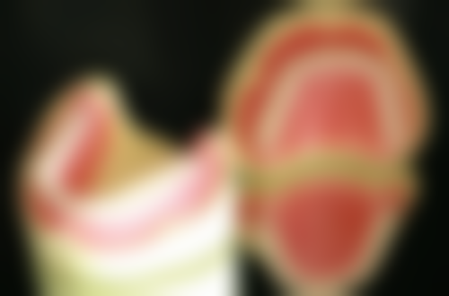 小苏打刷牙能去除牙结石吗？