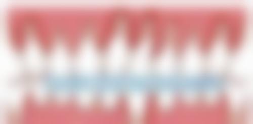 拔牙拍片后多久怀孕才安心呢？