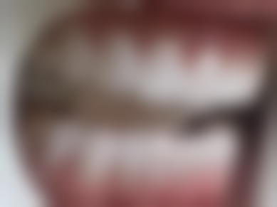 安吉爱齿口腔诊所收费价格表