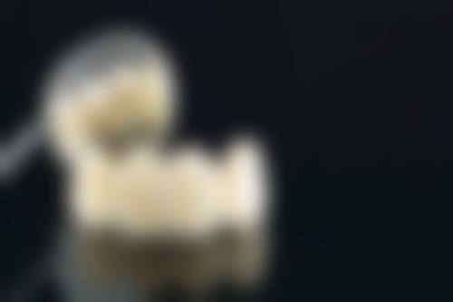 安装牙冠后需要注意什么呢？