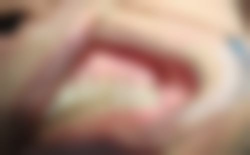 烟台仁峰口腔(北马路分院)怎么预约