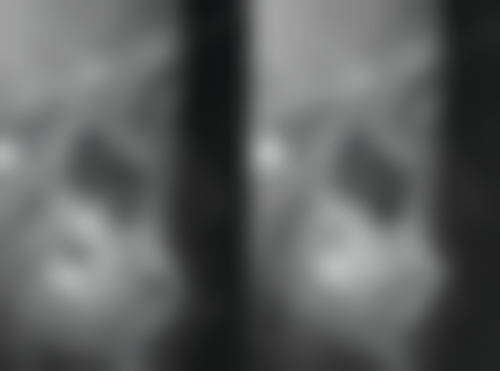 北京嘉信泽洋口腔怎么预约