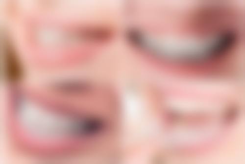 口腔医院随丽娜医生擅长项目