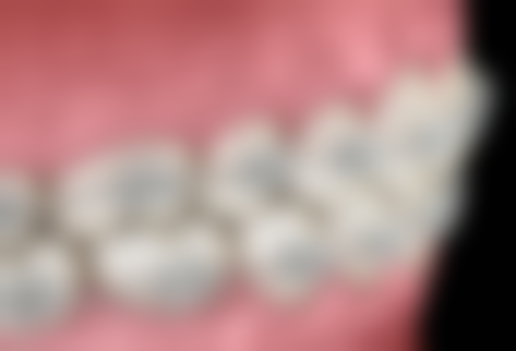 深圳诺德沙井口腔门诊部怎么预约