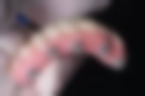 河南郑州华瑞口腔医院正规吗？