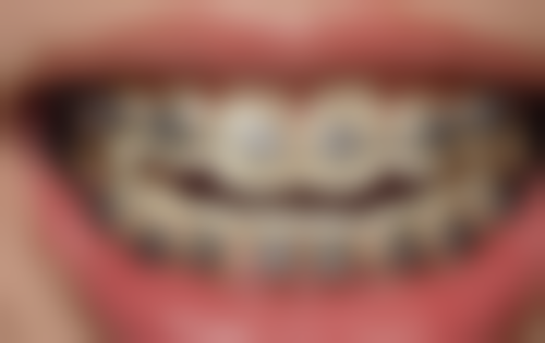 惠州陈树庆口腔诊所雷振萍医生患者评价