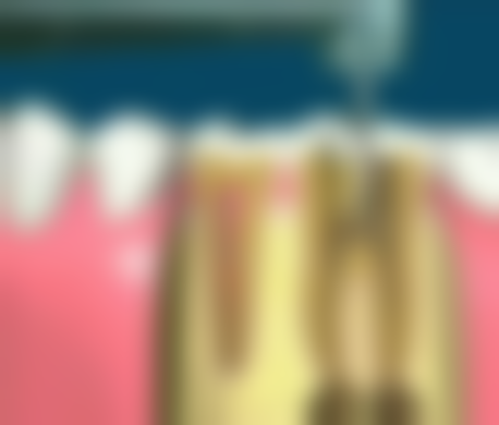 安心使用冲牙器有哪些建议呢？