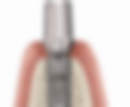 上海虹桥医院口腔美容中 心怎么预约