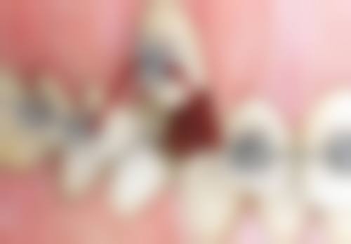 深圳罗湖区人民医院(春风院区)口腔科正规吗？