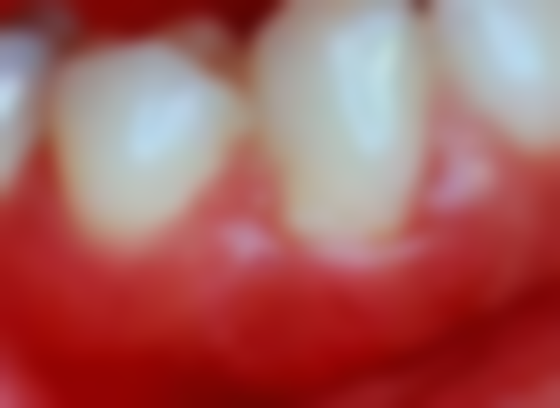 南昌泰博口腔正规吗？