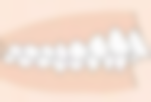 广州医学校口腔医院朴正国医生擅长项目