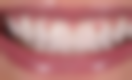 除了针对原因的修复方法，还有其他修复方式吗？