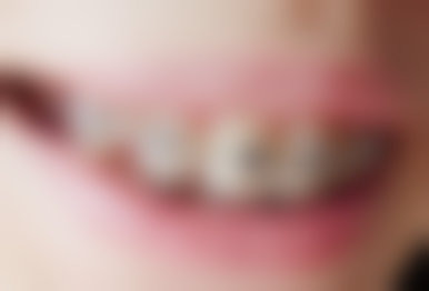 深圳博亚口腔门诊部游军 医生患者评价